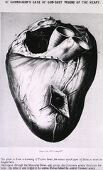 Anglų lietuvių žodynas. Žodis cardiovascular reiškia a anat. širdies ir kraujagyslių lietuviškai.