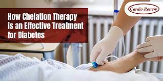 The Benefits Of EDTA Chelation Therapy For Diabetes For Your Wellbeing