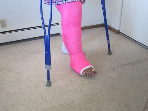 My Cast, Crutches and Toes