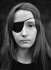 Marnie Aves with eye patch