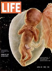 Life Before Birth 00 - Cover - LIFE Magazine 30 April 1965