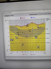 Right ear versus sound